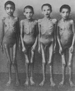 Crianças, vítimas das experiências "médicas" do monstruoso Dr.Josef Mengele, em Auschwitz-Birkenau. Polônia, 1944.