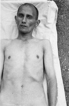 Cigano vítima das experiências médicas nazistas para transformar água marinha em água potável. Campo de concentração de Dachau, Alemanha, 1944.